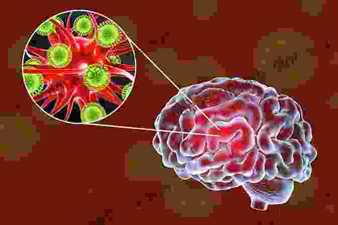 Microscopic View Of Encephalitis Virus Infecting Brain Cells Underwater: When Encephalitis Brain Injury And Epilepsy Change Everything