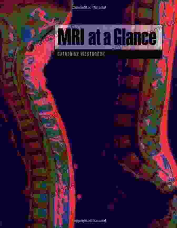 MRI At A Glance Book Cover MRI At A Glance Catherine Westbrook