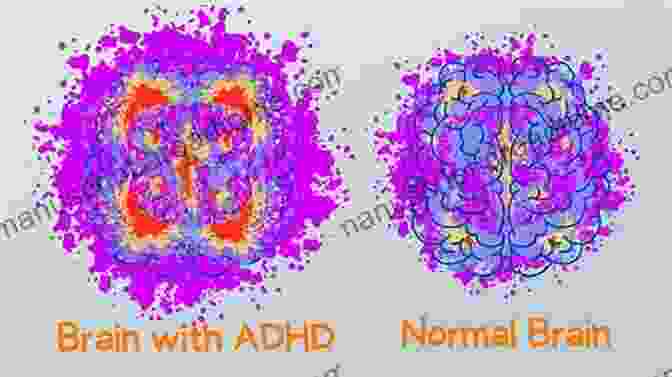 MRI Scan Of A Brain With ADHD Showing Differences In Activity Compared To A Neurotypical Brain The Science Of ADHD: A Guide For Parents And Professionals